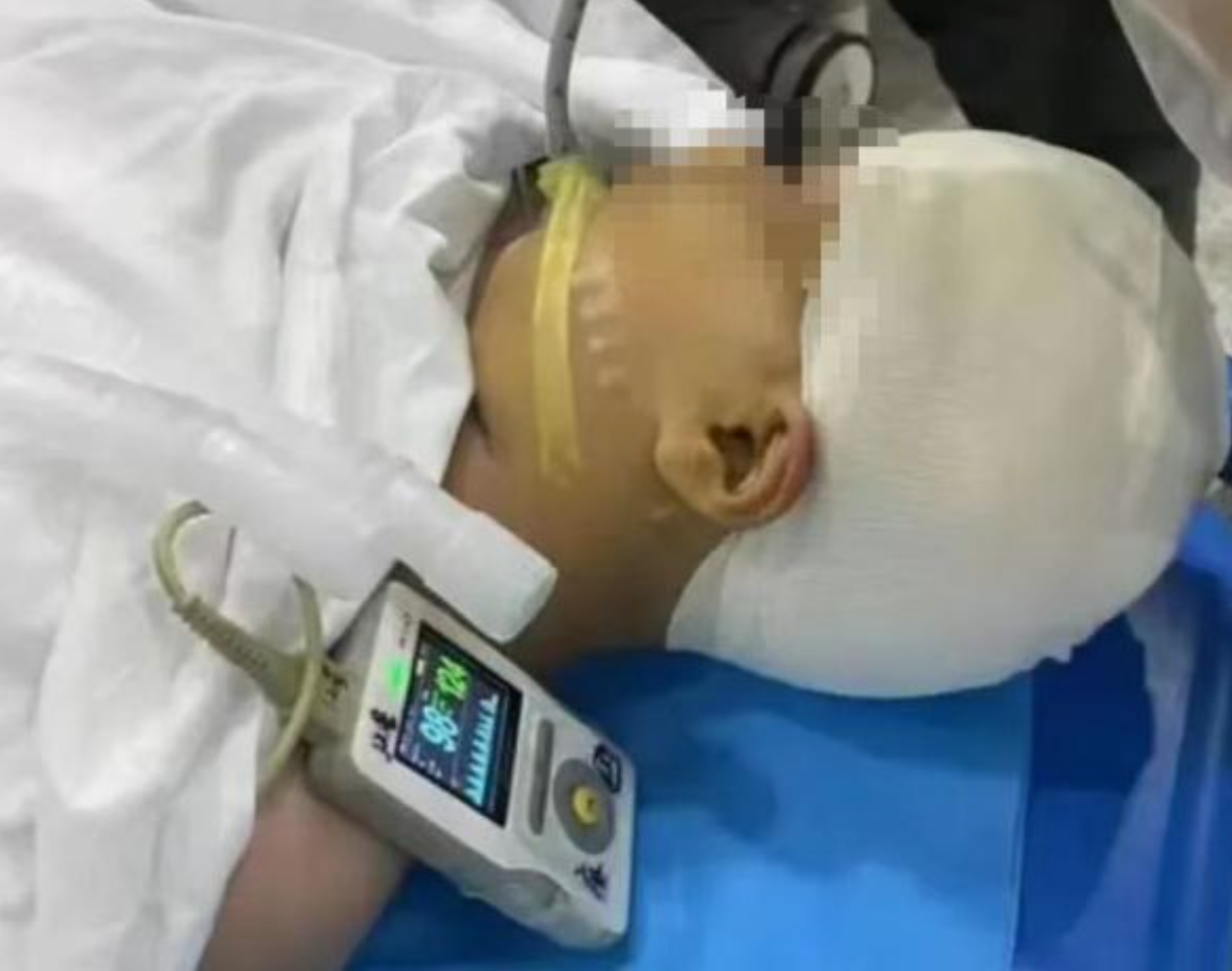 湖南老師打破學生頭骨腦漿流出　受害9歲女童甦醒後駁誤傷說法