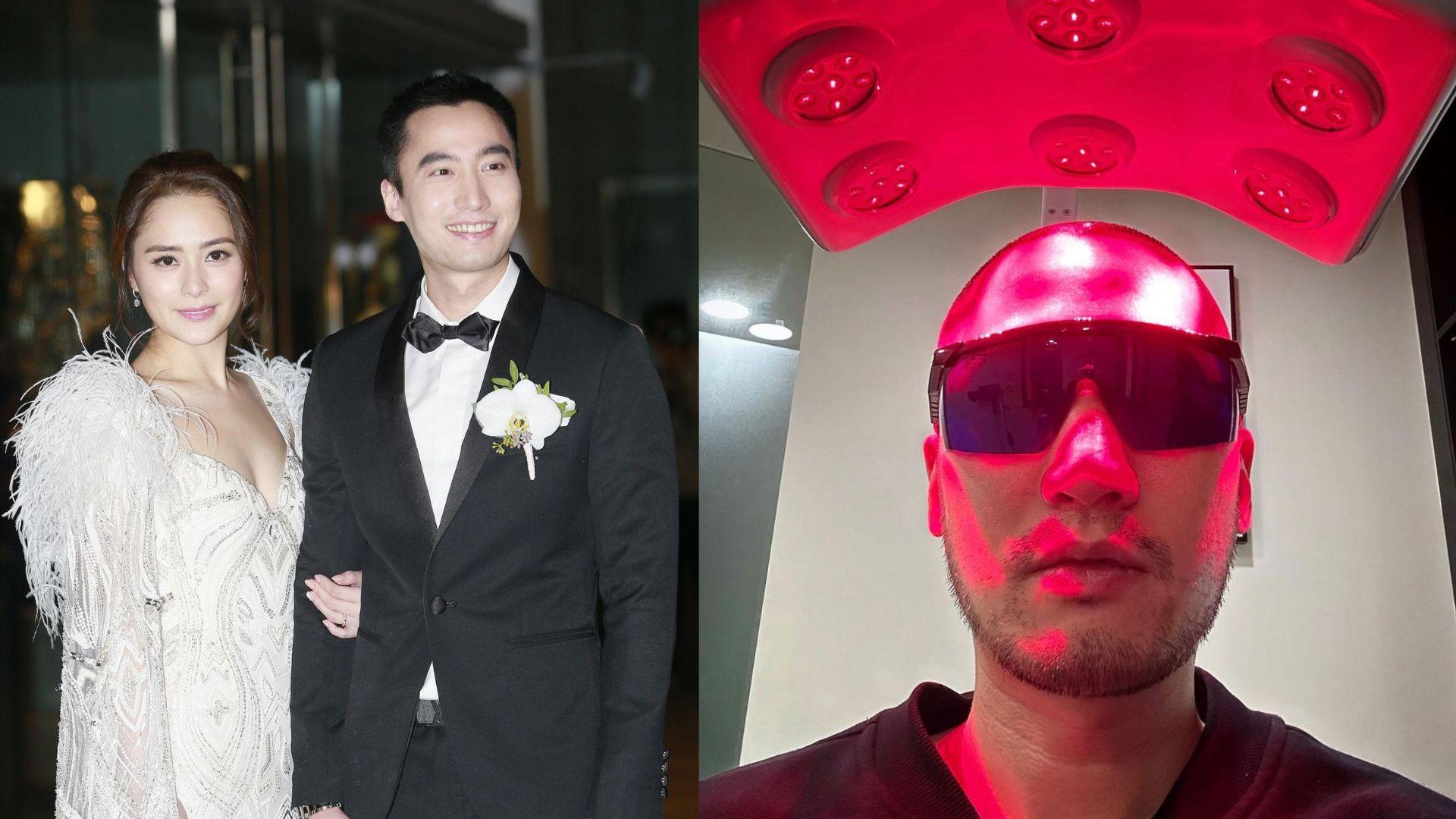 阿嬌鍾欣潼前夫驚變光頭 賴弘國鼓起勇氣認植髮