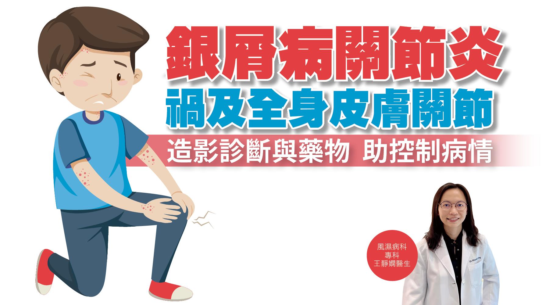 健康解碼｜銀屑病關節炎 禍及全身皮膚關節 造影診斷與藥物 助控制病情