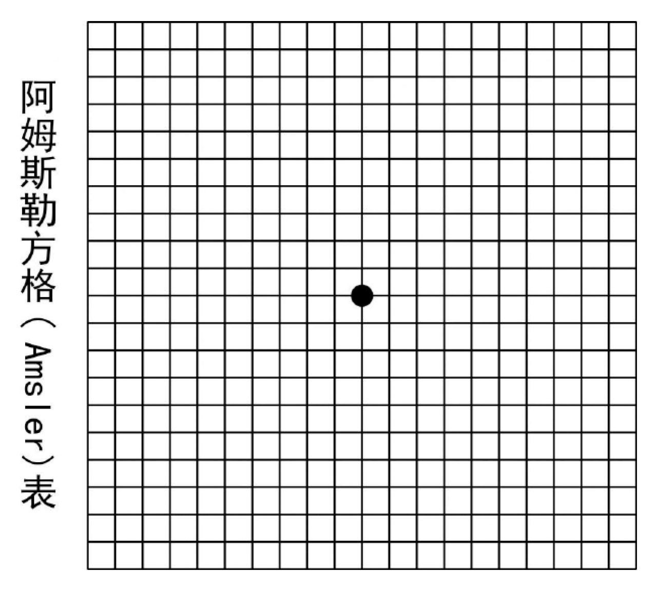 診斷老年黃斑病變