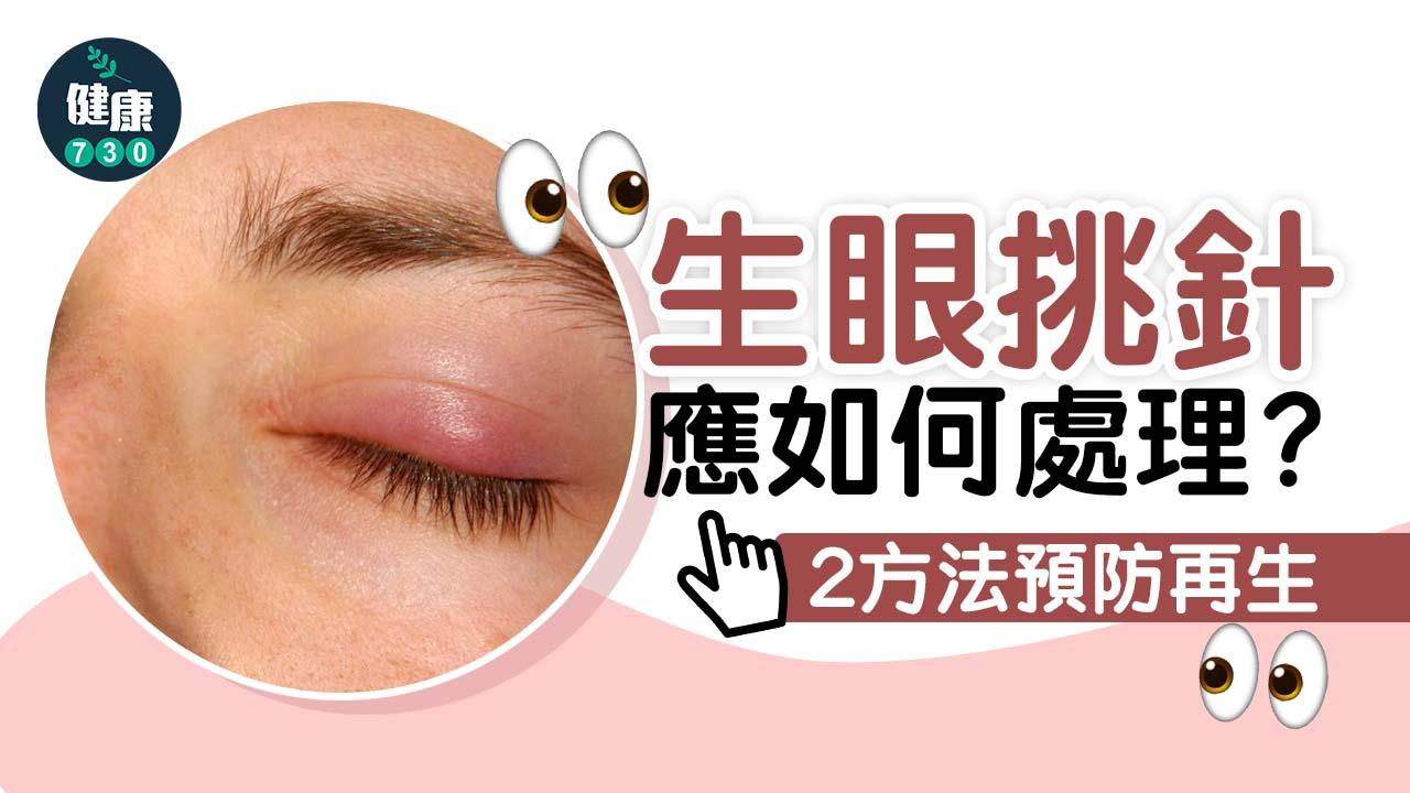 眼挑針｜點解會生眼挑針？應如何處理？2方法預防再生！