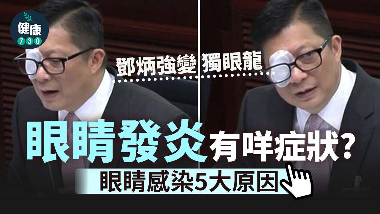 眼睛感染｜鄧炳強變獨眼龍 眼睛發炎有咩症狀？生蛇、性病都可能係原因？
