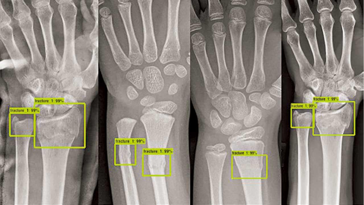 生物資訊學：引領生物科技的未來