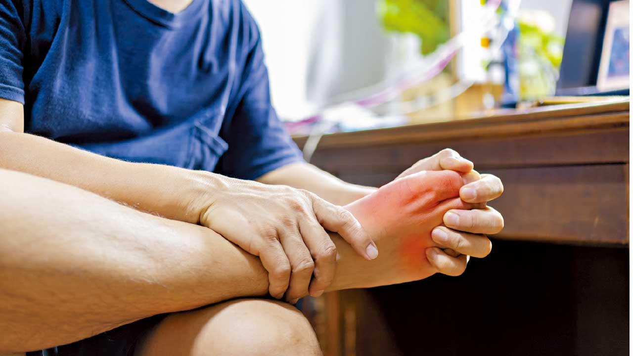 痛風治療 戒口非重點