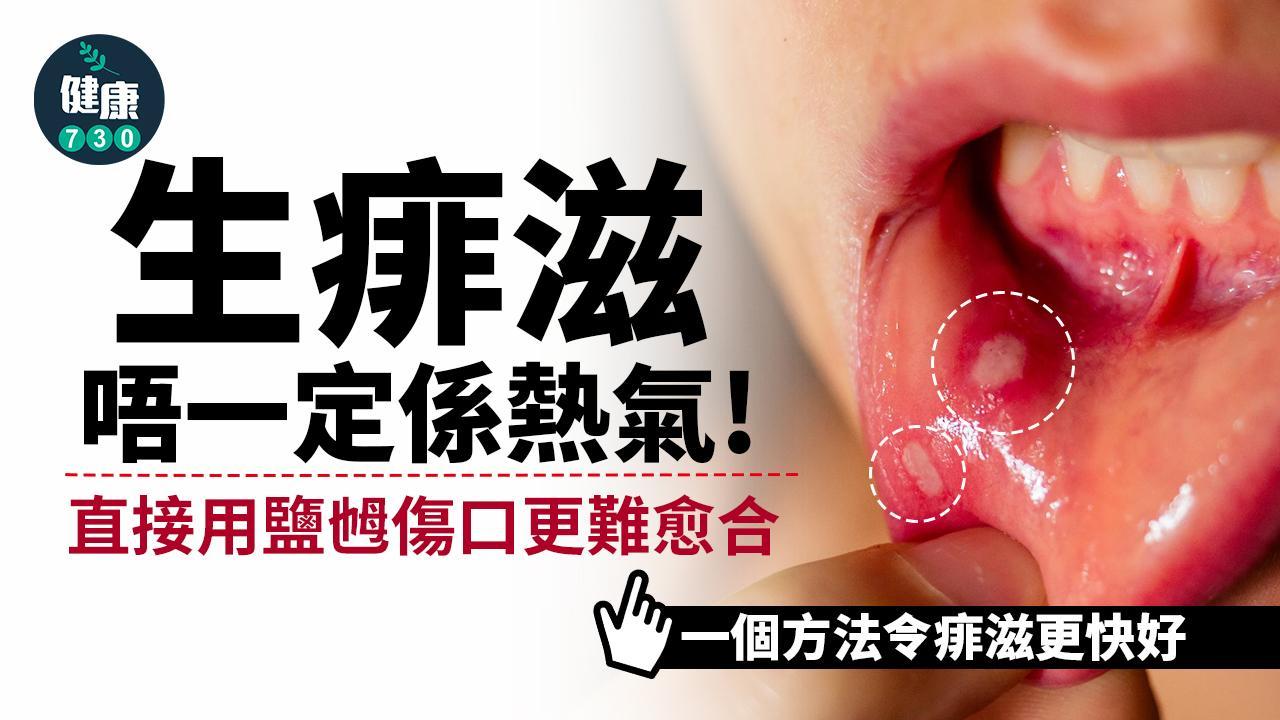 生痱滋原因唔一定係熱氣 解決方法唔係用鹽乸?