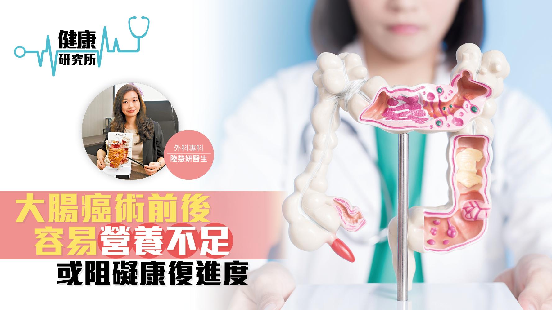 健康研究所｜大腸癌術前後容易營養不足 或阻礙康復進度