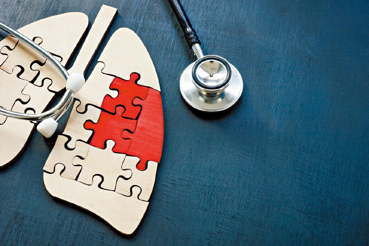 早期肺癌 做手術就夠？