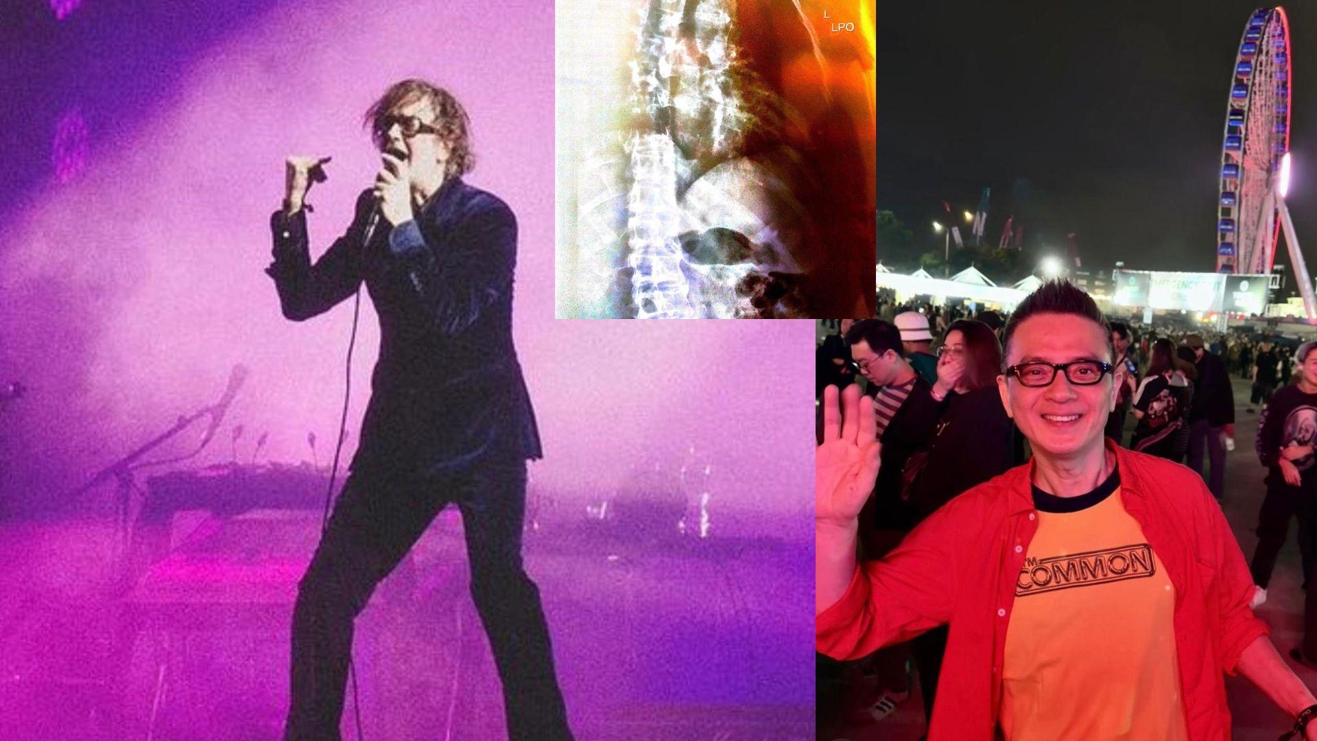 Clockenflap 2023｜Pulp主音Jarvis Cocker帶傷上陣 抵香港後碌落樓梯斷兩條肋骨