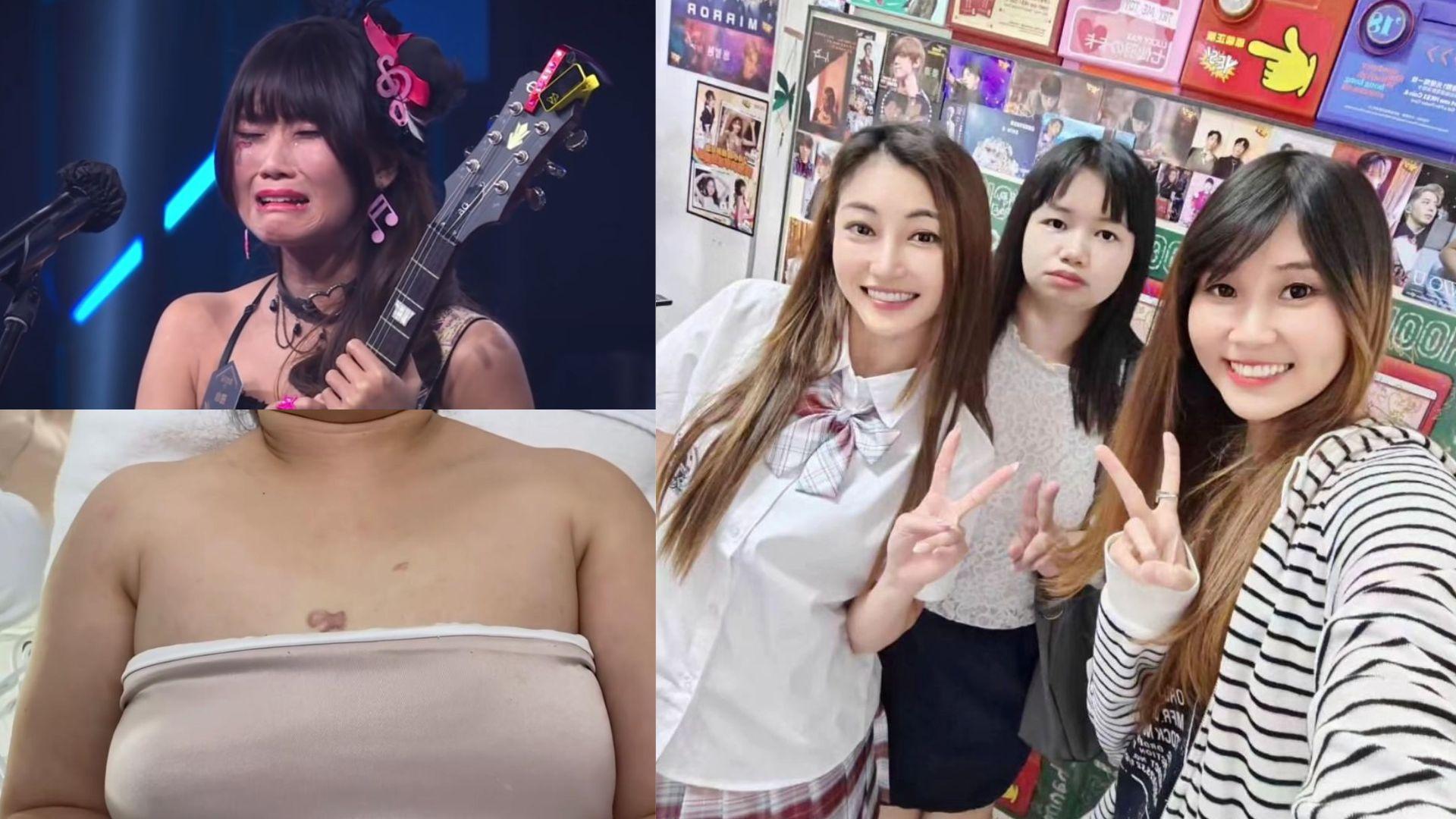 薛影儀打開心口接受去疤痕療程  《全民造星III》葉小妍否認係「損友2號」