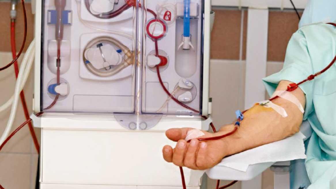 血液透析(洗血)