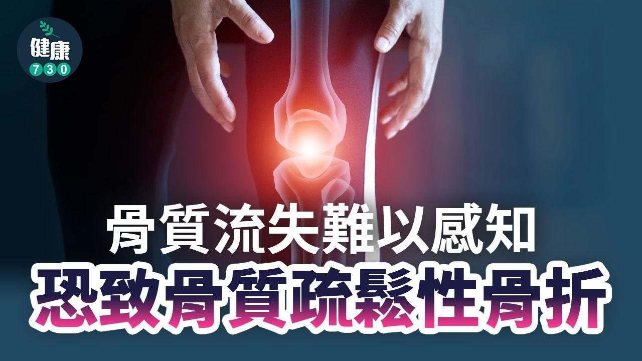 骨質疏鬆｜骨質流失難以感知　恐致骨質疏鬆性骨折