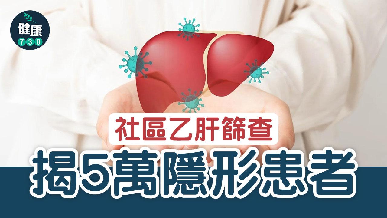 乙型肝炎｜社區乙肝篩查 揭5萬隱形患者