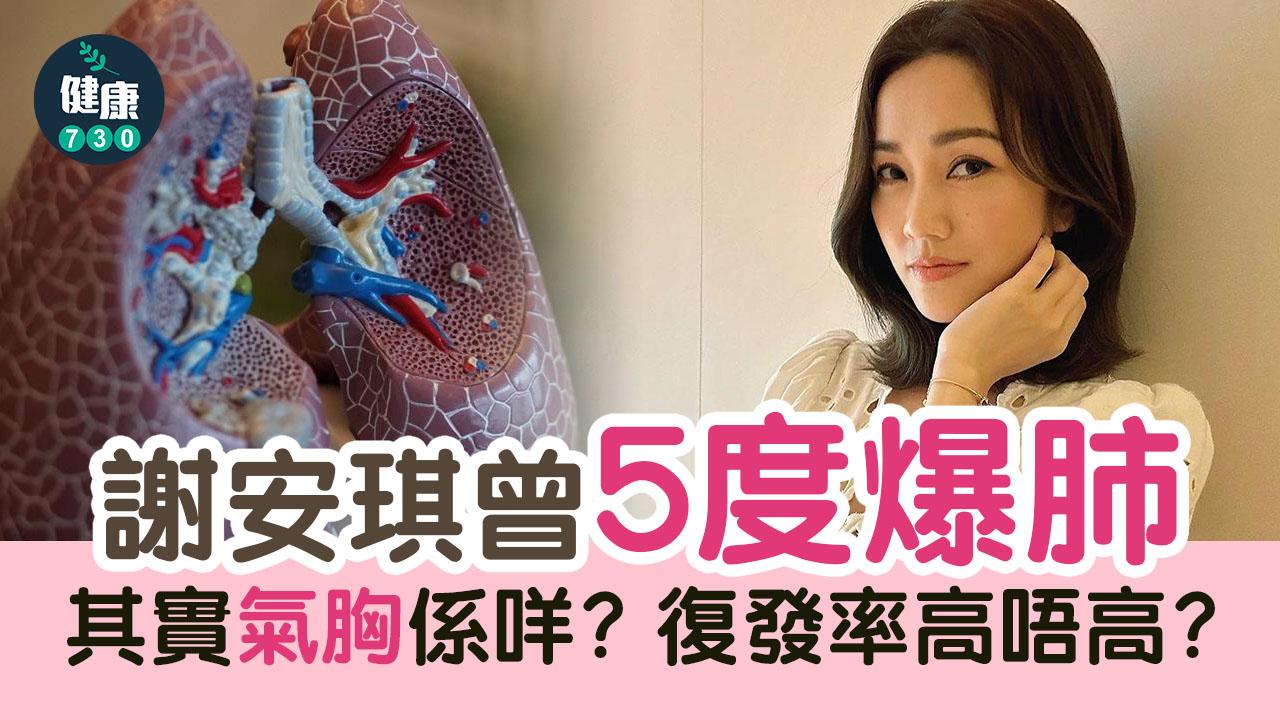 氣胸｜謝安琪曾5度爆肺 其實氣胸係咩？復發率高唔高？