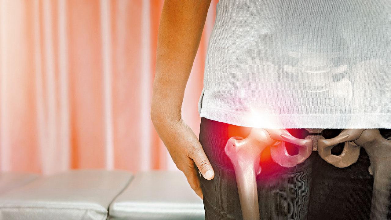 副甲狀腺亢進 血鈣高易骨折