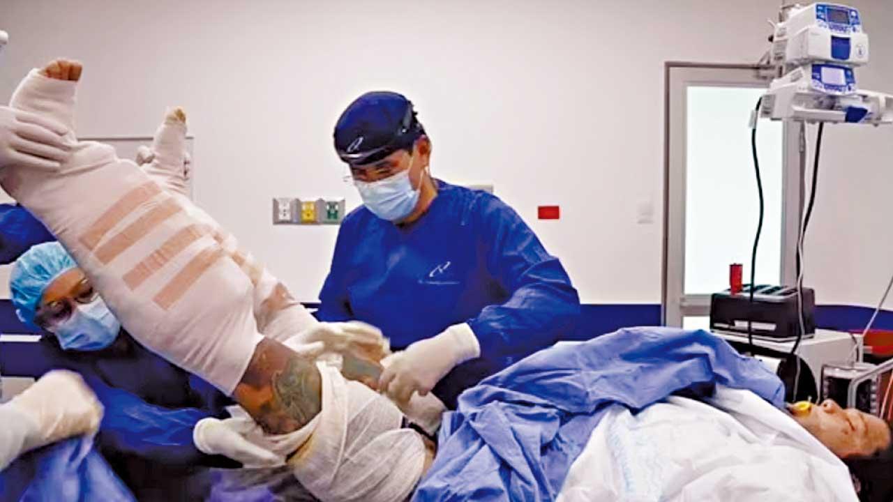 親試「全球最痛手術」網紅斷骨增高︰痛到睡不到