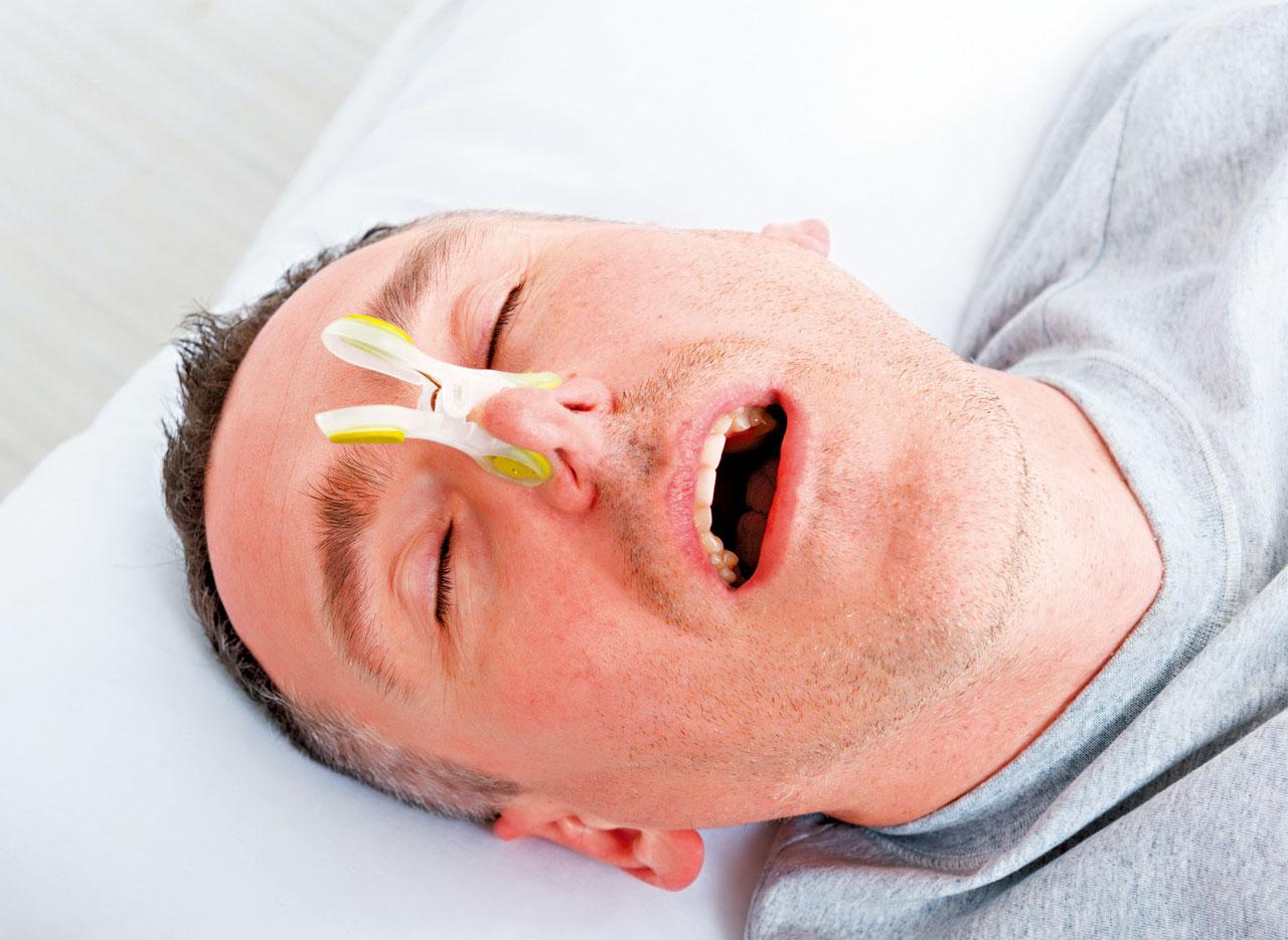 中大引入舌下神經刺激治療 治阻塞性睡眠窒息