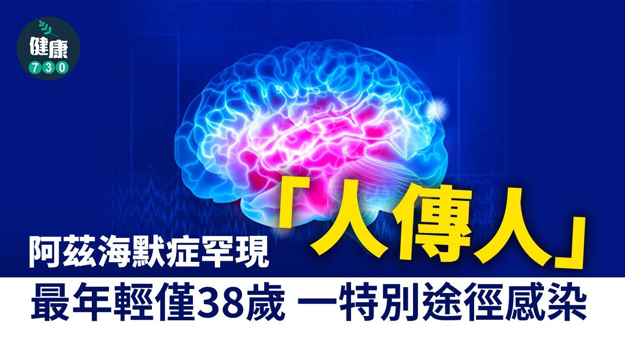 阿茲海默症罕現「人傳人」 最年輕僅38歲 一特別途徑感染