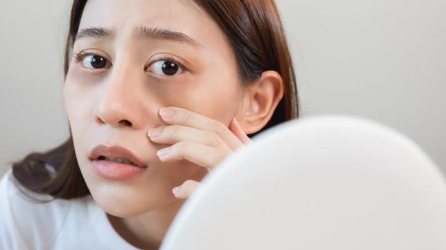 過年常有「這些」皮膚問題　醫生授保養小撇步！捱夜捱出黑眼圈也有解方