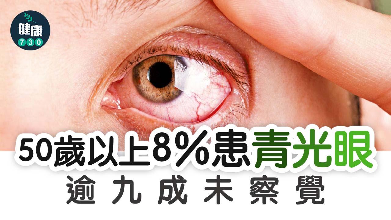 50歲以上8%患青光眼 逾九成未察覺