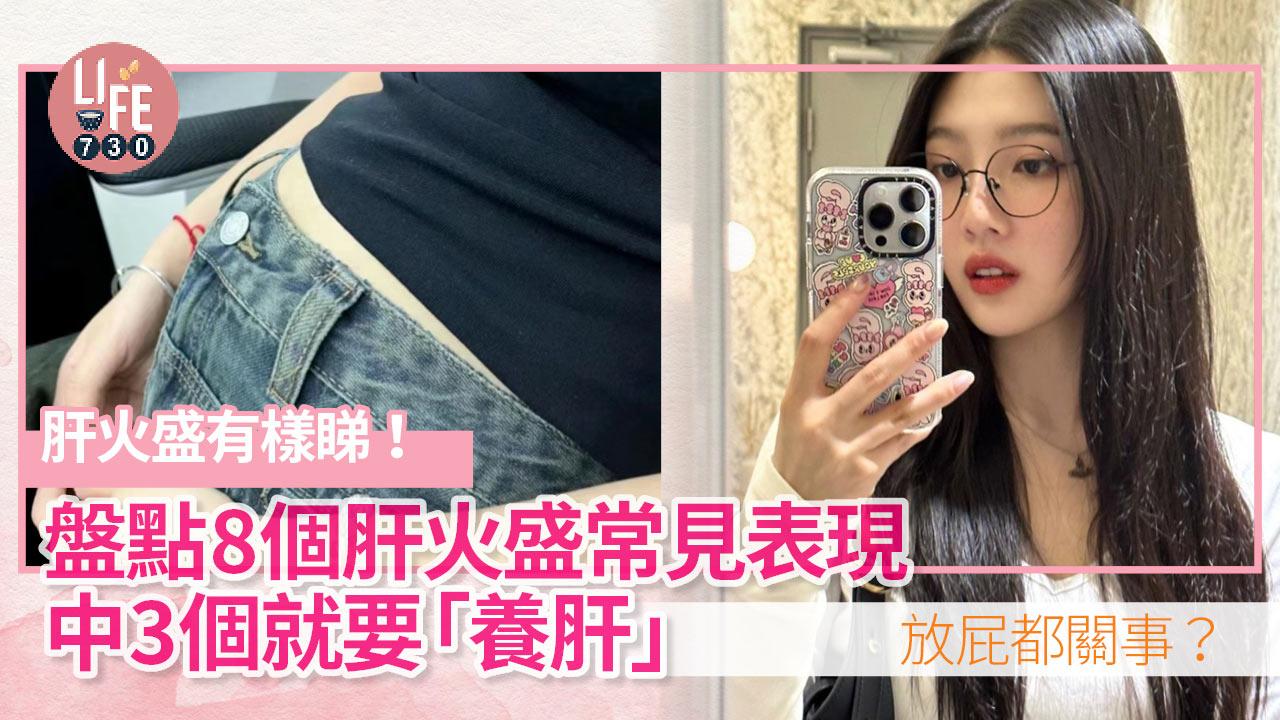 健康養生｜肝火盛有樣睇！盤點8個肝火盛常見表現 中3個要「養肝」