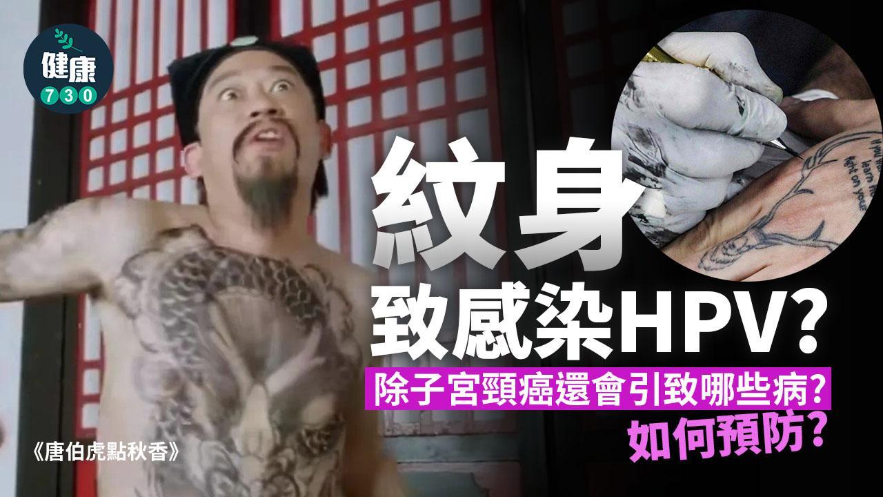 HPV｜紋身致感染人類乳頭瘤病毒？詳解原因、引致疾病及預防方法（am730製圖）
