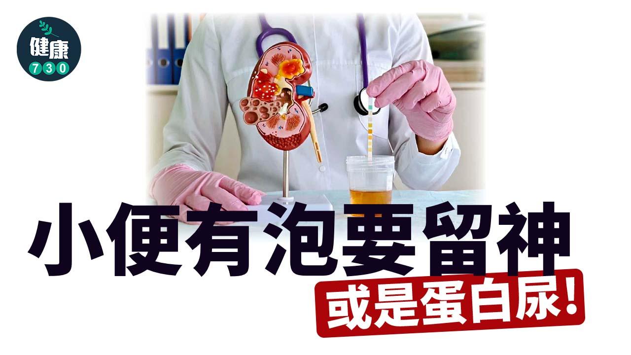 小便有泡要留神 或是蛋白尿！