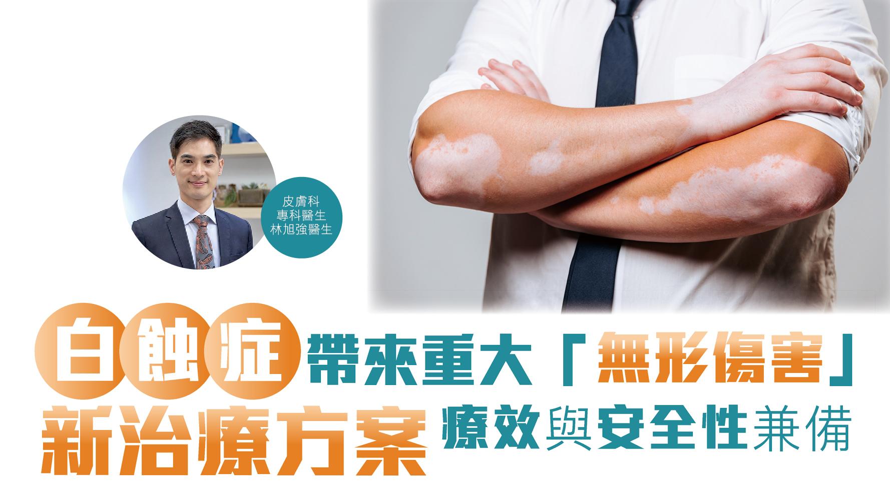 白蝕症帶來重大「無形傷害」 新治療方案 療效與安全性兼備