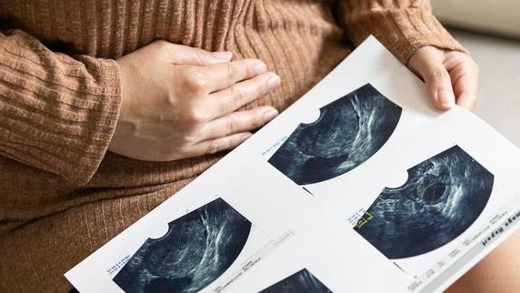 更年期出血很正常？她一檢竟是「子宮內膜癌前病變」　醫籲這樣預防