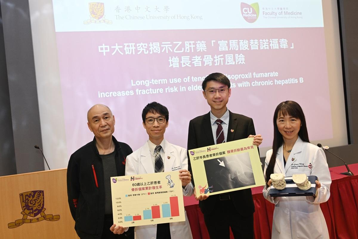 中大醫學院團隊研究發現，有一款乙型肝炎藥物會增加長者骨折風險；圖左二起為黎梓滔、葉卓風和黃麗虹。(中大醫學院提供)