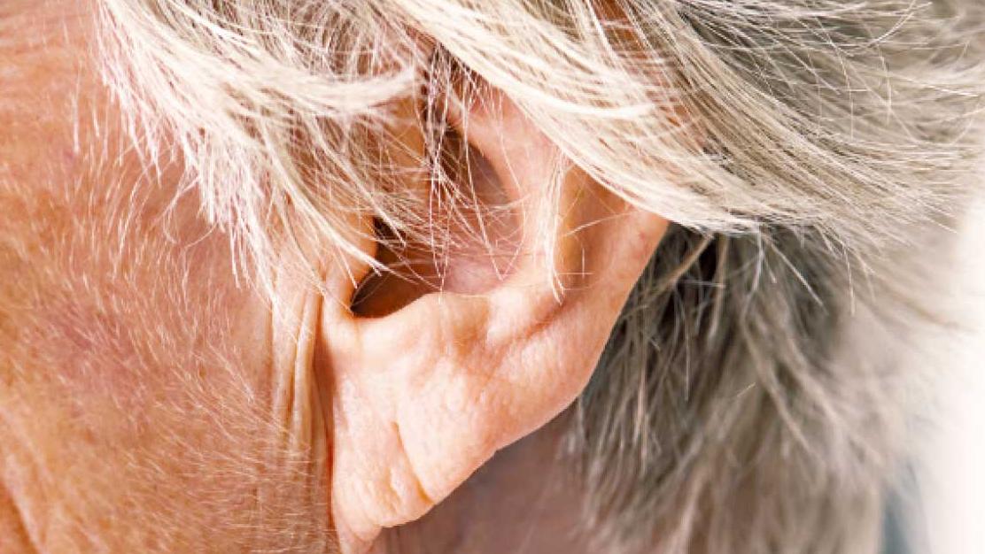 老年性耳鳴耳聾的防治