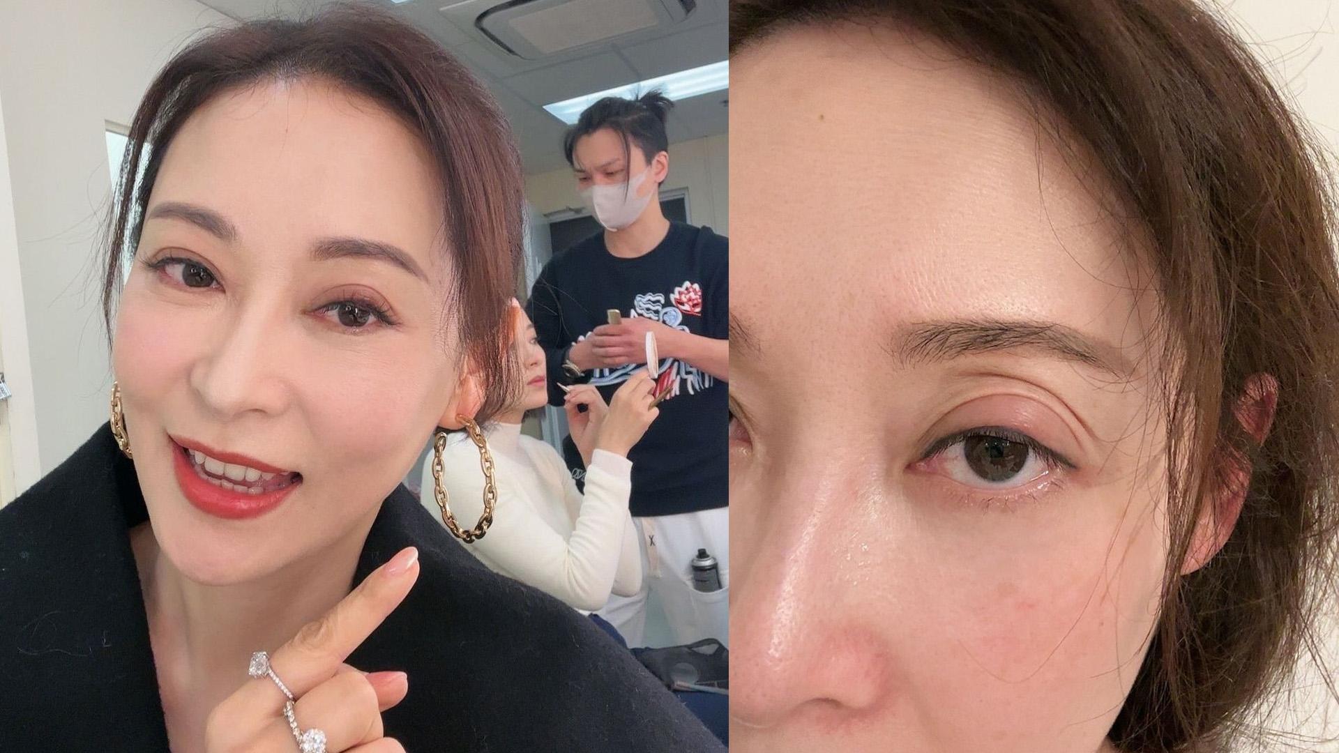 楊卓娜生眼瘡變專家  大細眼同細妹楊茜堯開工