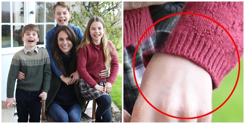 英國王室周日(10日)發放威爾士王妃凱特於1月手術出院後首張官方相片，惟4間國際圖片通訊社刊登不夠一日後，決定下架相片，指有關相片可能被加工，不符合公司的圖片標準。