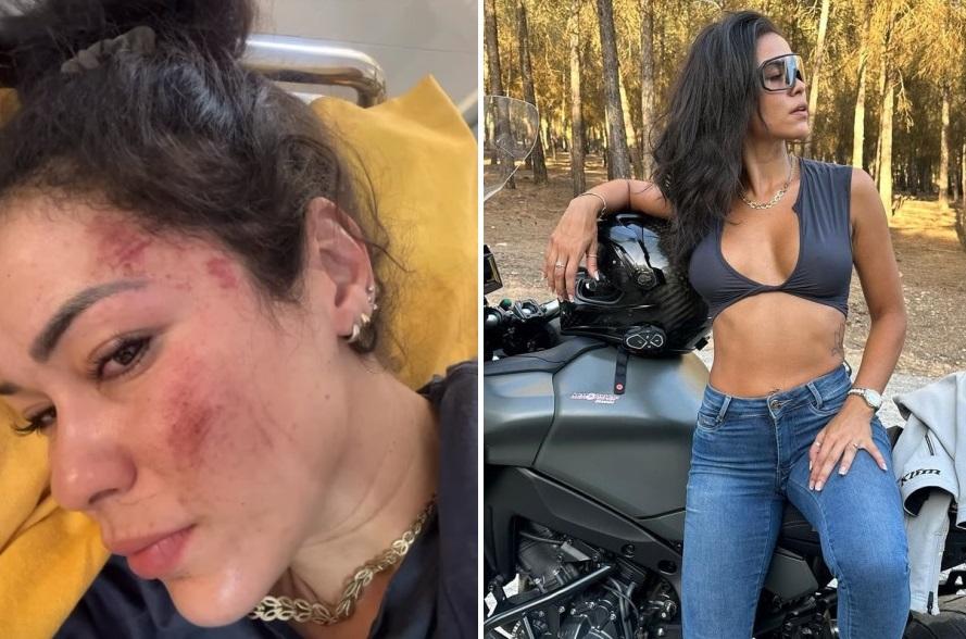 左圖：南達案發後上傳她臉部疼傷的照片，右圖：南達IG不乏性感照片。(互聯網)