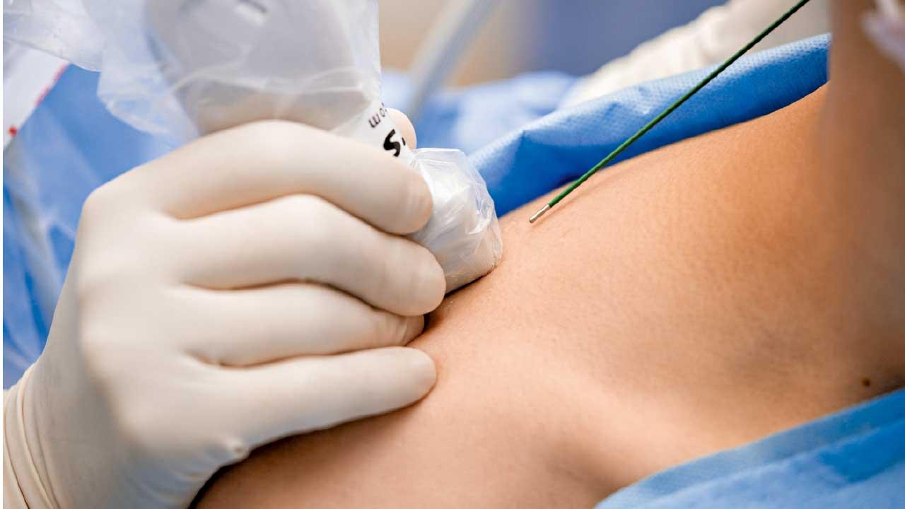 逾四成港人有長期痛症 持續3個月應就醫