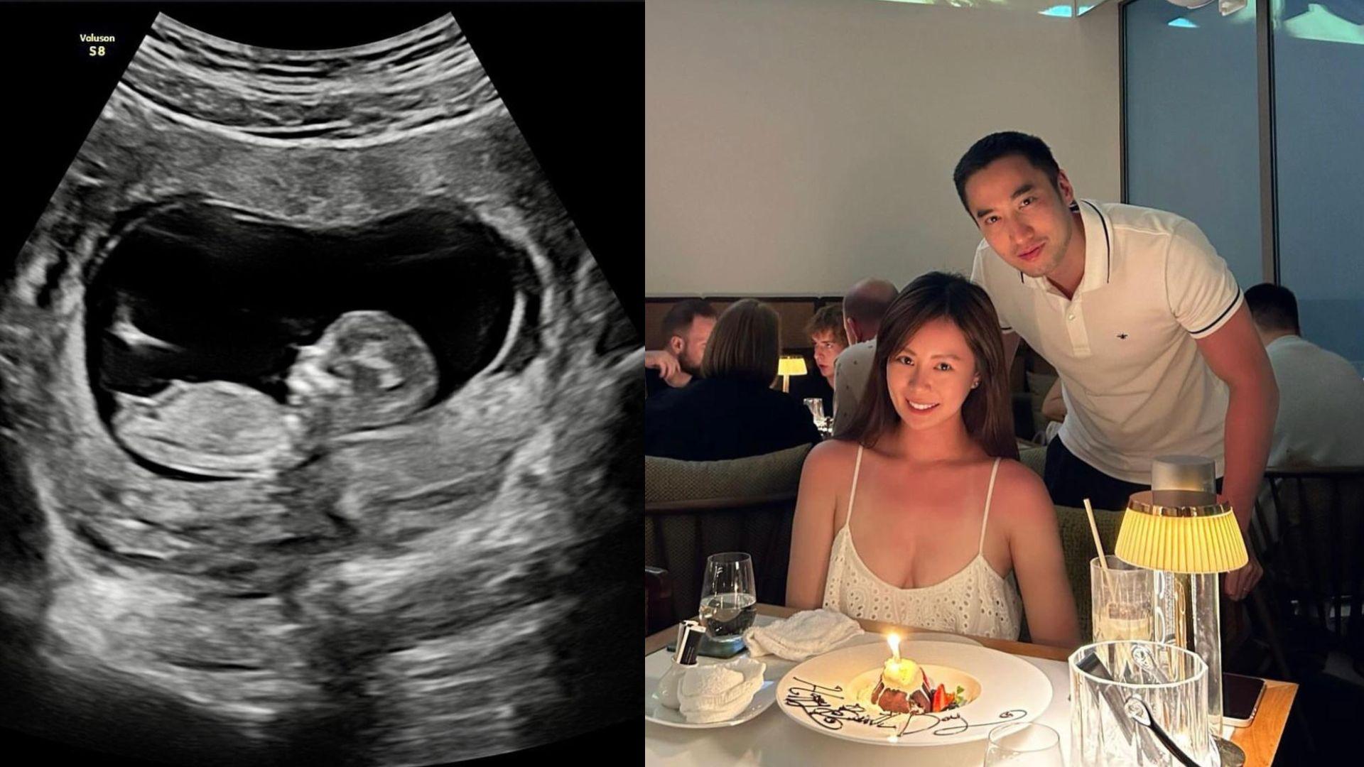 阿嬌前夫賴弘國植髮見效再報喜 造人成功宣布老婆陀龍B