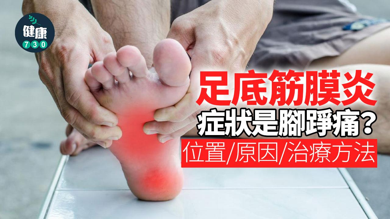 足底筋膜炎症狀是腳踭痛？位置、原因、治療方法一文了解