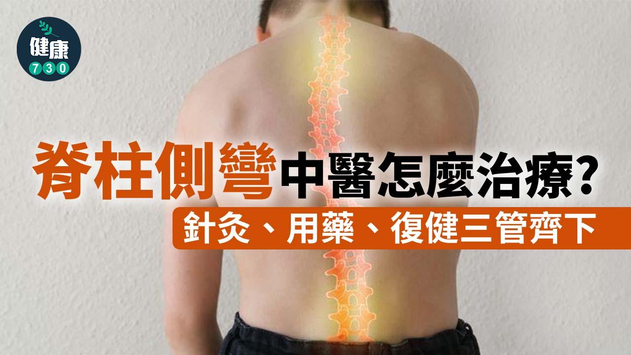 脊柱側彎中醫怎麼治療？　針灸、用藥、復健三管齊下