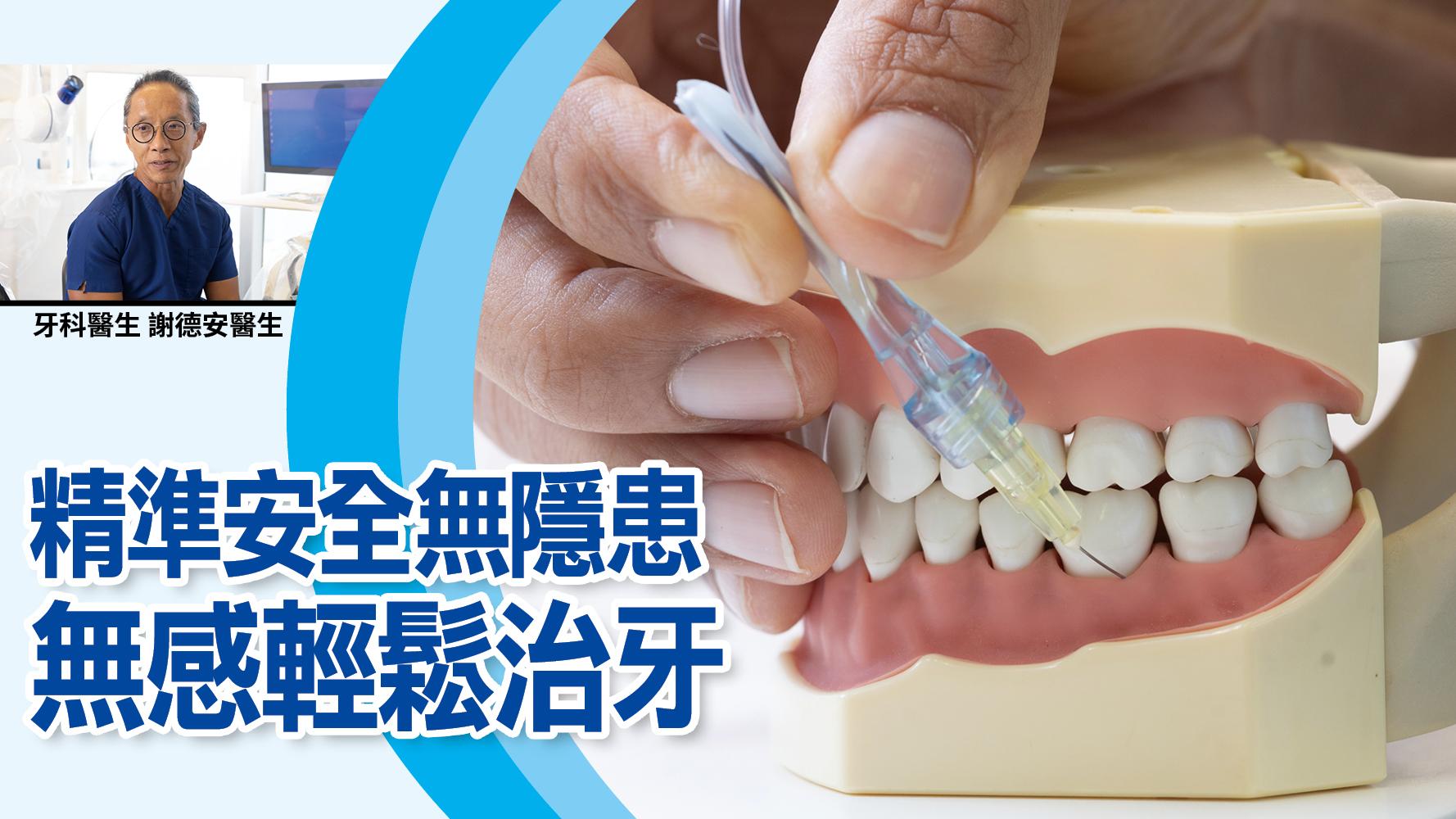 精準安全無隱患 無感輕鬆治牙