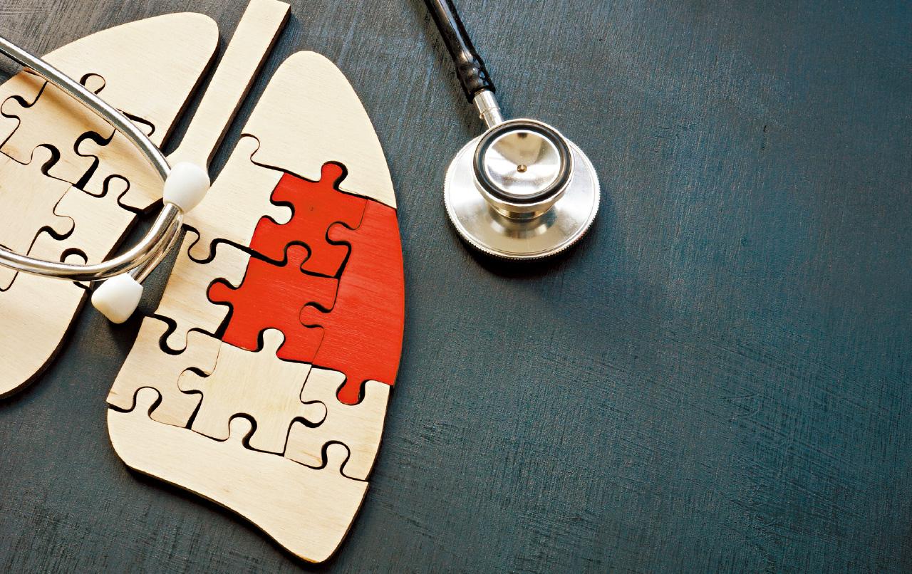 初期肺癌冇病徵 宜盡早篩查