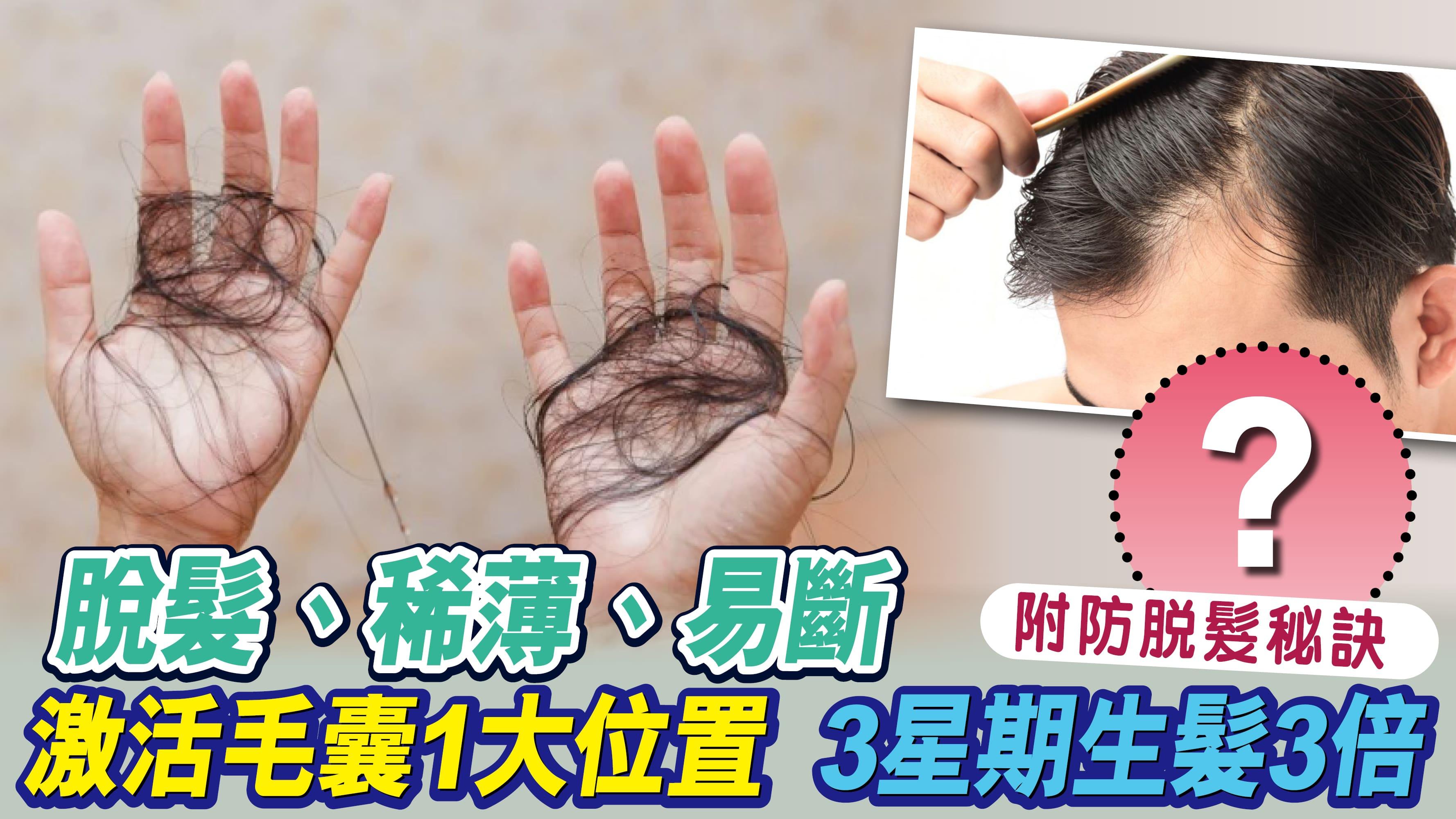 脫髮、稀薄、易斷？激活毛囊1大位置！3星期生髮3倍