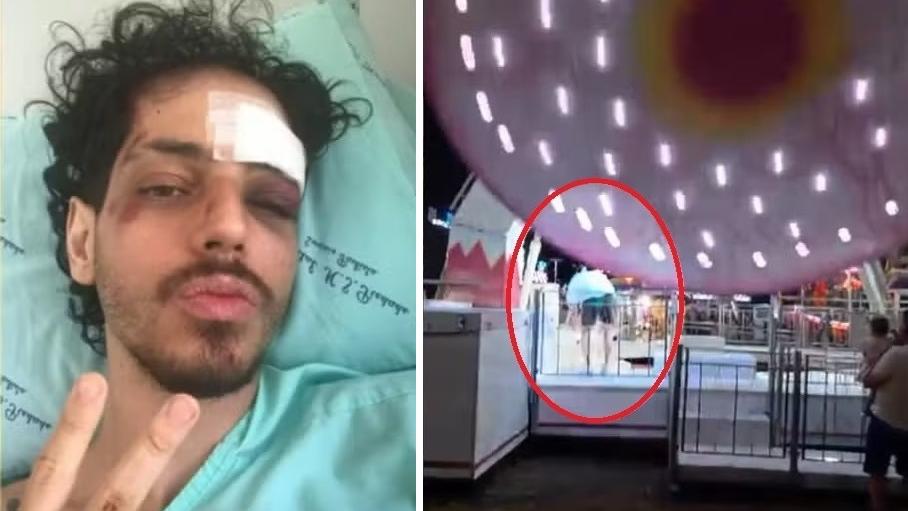 特謝拉衝入機動遊戲平台救狗，結果被大鐘擺狠狠撞到，身受重傷。(互聯網)