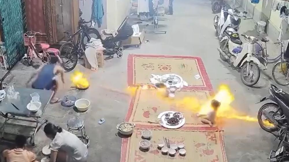 酒精煨魷魚變「火箭」，射中女童秒成火人。(X)