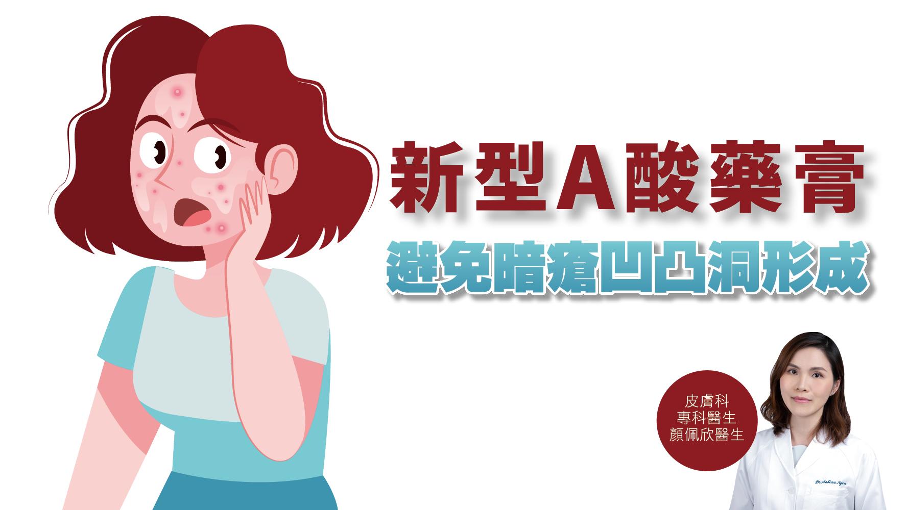 健康解碼｜新型A酸藥膏 避免暗瘡凹凸洞形成