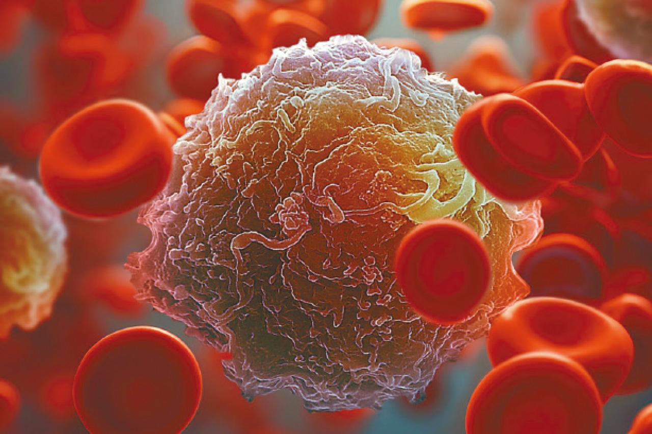 CTC檢測防癌症勝於治腫瘤？