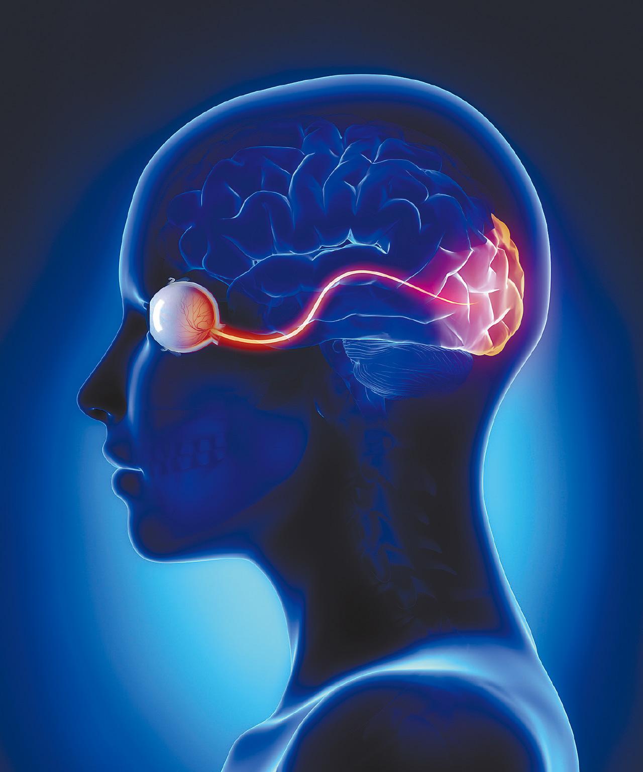 視神經脊髓炎 一次復發足以致命