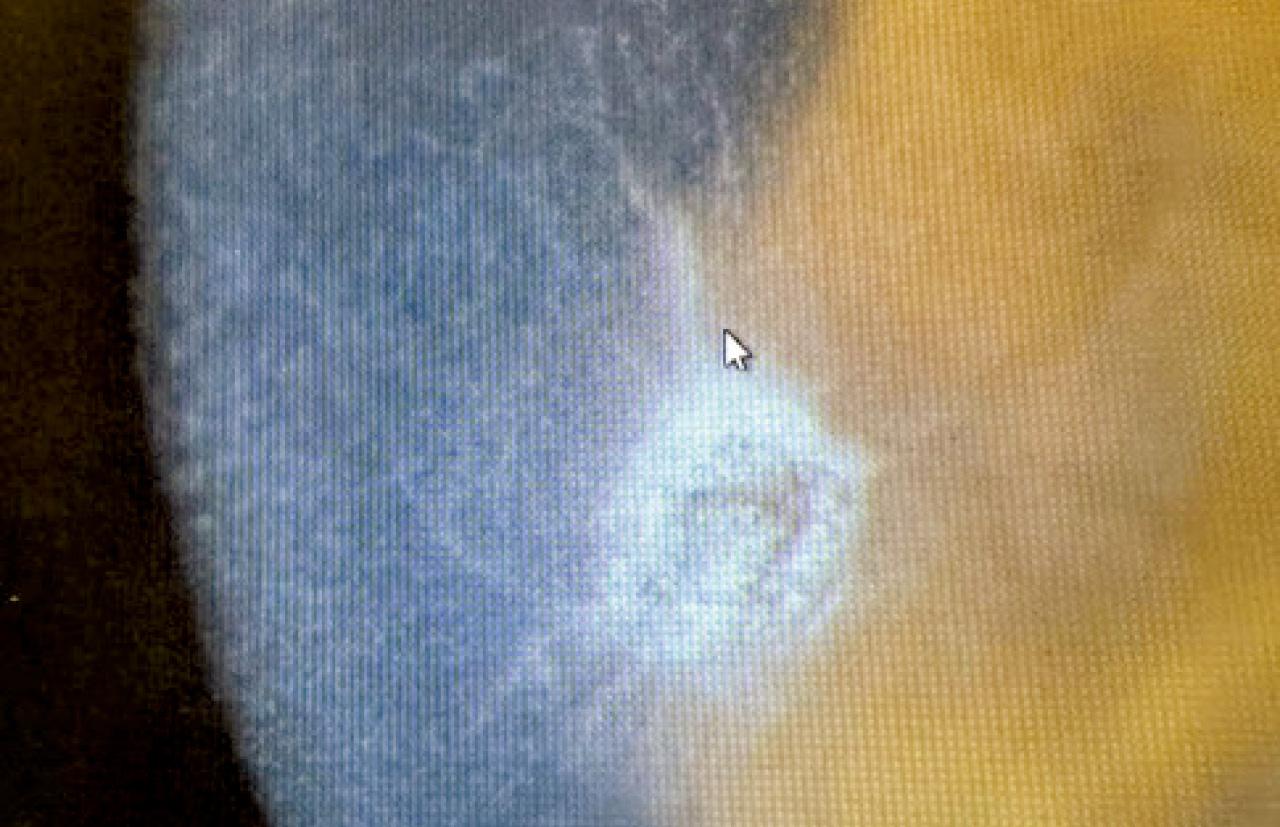 眼角膜上的小爪