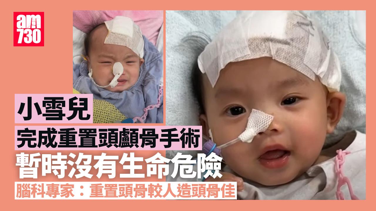 屯門虐嬰案｜小雪兒完成重置原頭骨手術 腦科專家：較人造頭骨佳