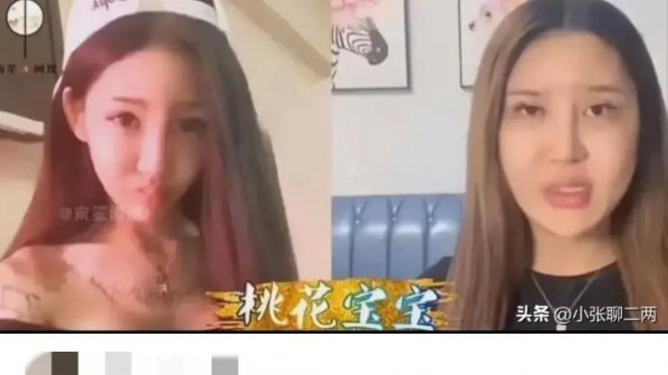 網紅為打造翹臀赴泰狂注射「400支玻尿酸」　　屁股感染化膿出水