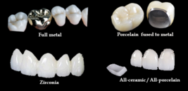 杜牙根一定痛？有沒有後遺症？