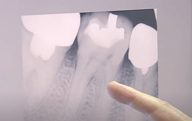 中國男在南韓植牙致下顎骨折出血亡　妻批診所「無視外國人」